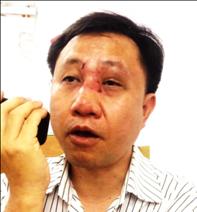 Nguyen Bac Truyen after his aggression on 24 February 2014