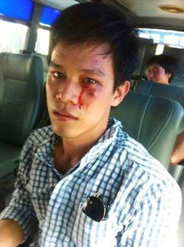 Một biểu tình viên khác bị đánh chảy máu mắt đang bị bắt trên xe buýt